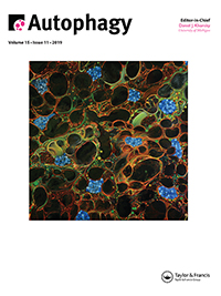 Small molecule-driven NLRP3 inflammation inhibition via interplay between ubiquitination and autophagy: implications for Parkinson disease